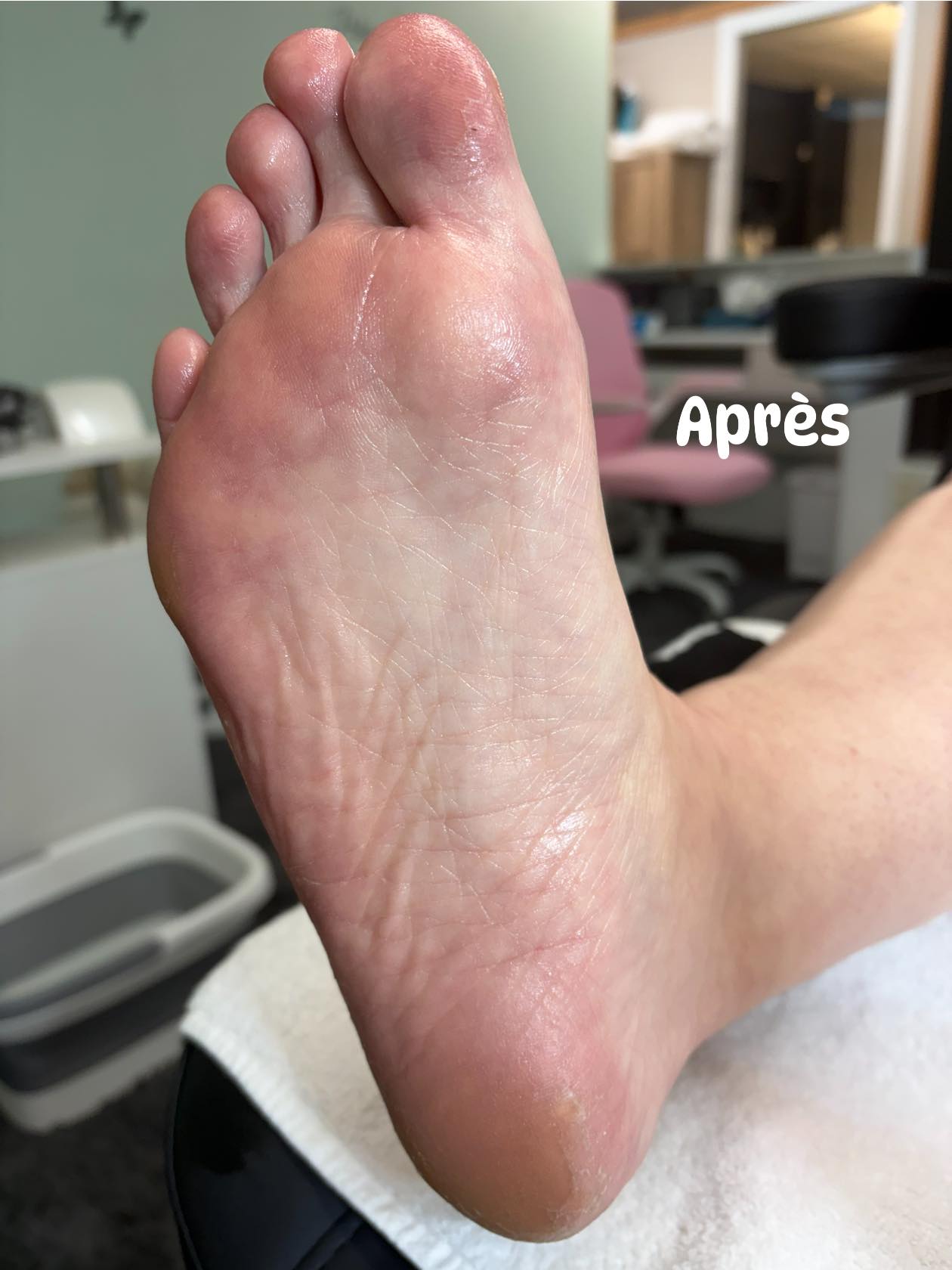 Après — peau hydratée