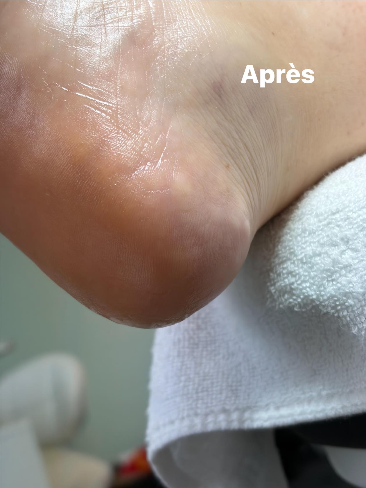 Après — talon lisse